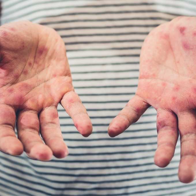 Infectious Disease Cleanup In Alabama	Near Me